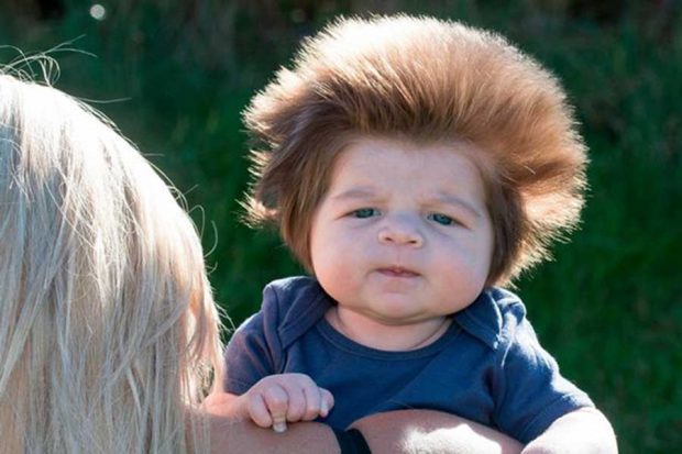 تصاویری از موهای پرپشت کودک دوماهه