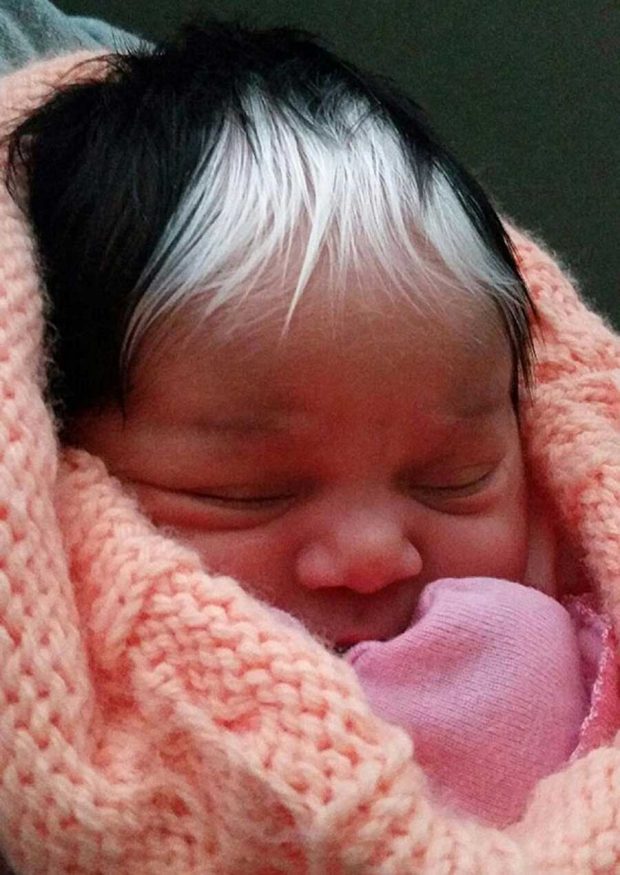 تصاویری از نوزادی با موهای سیاه وسفید در کارولینای جنوبی